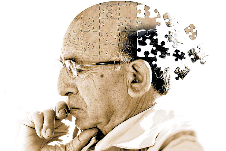 .jpg - آنچه باید درباره آلزایمر، روش‌های پیشگیری و درمان آن بدانید
